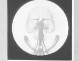 Proboscis of Blow Fly-Musca vomitoria, x25.