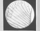 Proboscis of Blow Fly, minute structure, x1.