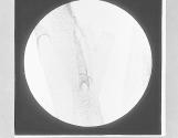 Trachaea of Silkworm. Spiral structure, x50.