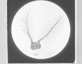 Antennae of Vapourer Moth. x7.