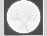 Tongue of Cricket-Acheta domestica, x20.