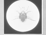 Parasite of Beetle-Gamasus Coleoptratorum x35.