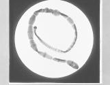 Tape Worm from Cat, x9.