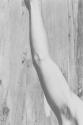 [Arm]