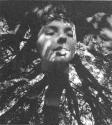 [Head in Tree]