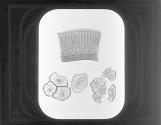 Tesselated and celeated epithelial cells