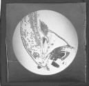 [Photomicrograph]