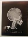 Kodak advertisement for Eastman Ultra-Speed Safety X-Ray Film