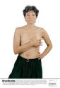 [Breast Cancer placard, image of woman  wearing black skirt, right arm across chest]