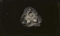 [Photomicrograph]