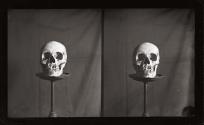 [Human skull]