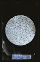 [Photomicrograph]