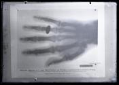 [Copy photograph of 1896 X-ray]
