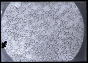 [Photomicrograph]