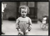 Child with rickets.