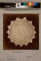 Spine of Echinus, transverse section, 21X