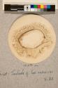 Tentacle of Sea Anemone, transverse section, 30X