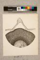 Fruit of Myprhis Odirata, transverse section, 10X