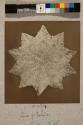 Spine of Echinus, transverse section, 55X