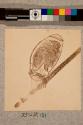Stalked egg, with embryo, of Parasite of Squrrel, 74X