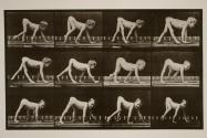 Infantile paralysis; child, walking on hands and feet