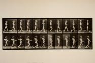 A, bow-legs; boy; B, spinal caries; girl, walking