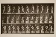 Multiple cerebro-spinal sclerosis (choreic); walking