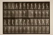 Lateral sclerosis; A, B, walking