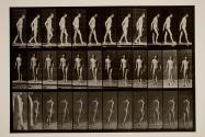 Disseminated sclerosis; walking with cane