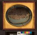 [Postmortem of young girl]