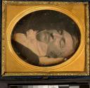 [Postmortem of man]