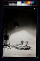 Children Under Sunlamps