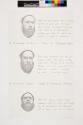 [Three images of bearded man's face]