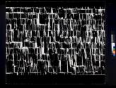 Shingles