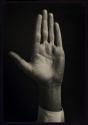 [Hand]