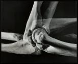 [Multiple exposure of the bones of a human forearm and its movement around the hingelike elbow joint]