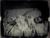 [Postmortem of child]