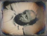 [Postmortem of man]