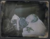 [Postmortem of child]