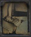[Postmortem of man]
