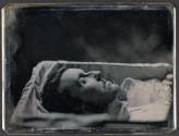 [Postmortem of man]