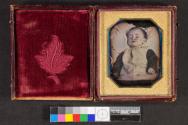 [Overexposed image of deceased child]
