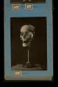[Human skull]