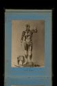 [Human anatomical model showing muscles and organs]