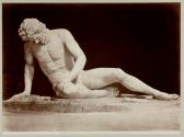 Dying Gaul
