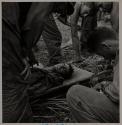 Navy Hospital Corpsmen tenderly lowering seriously wounded Marine Pfc. Arthur Norris Robison, 20, to the ground at a First-aid station on Guam.