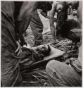 [Plasma on Guam - Navy Hospital Corpsmen tenderly lowering seriously wounded Marine Pfc. Arthur Norris Robison, 20, to the ground at a First-aid station on Guam on July 28, 1944...]