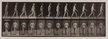 Lateral curvature of spine; walking