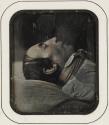 Doctor Amussat on his death bed