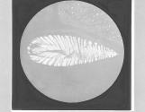 Spiracle of Blow Fly, x80.